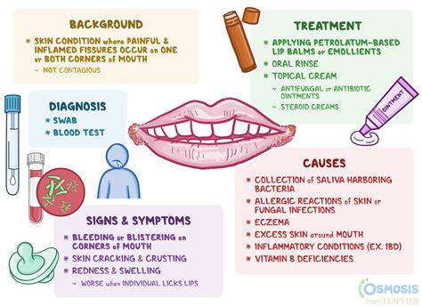 queilitis angular|Angular Cheilitis: Symptoms, Causes, Treatments